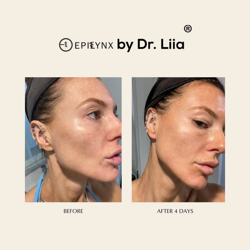 Pore Refining Serum for Redness & Scars
