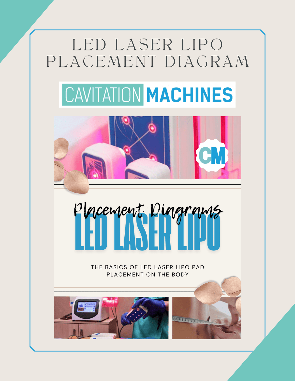 Shape Tactics LED Laser Lipo Placement Diagrams