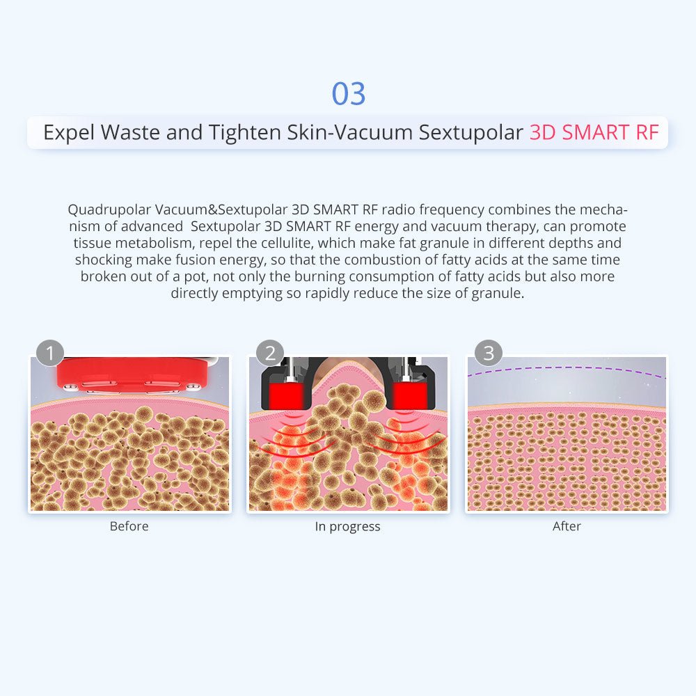 Shape Tactics 6-in-1 Unoisetion Cavitation RF 160mW System