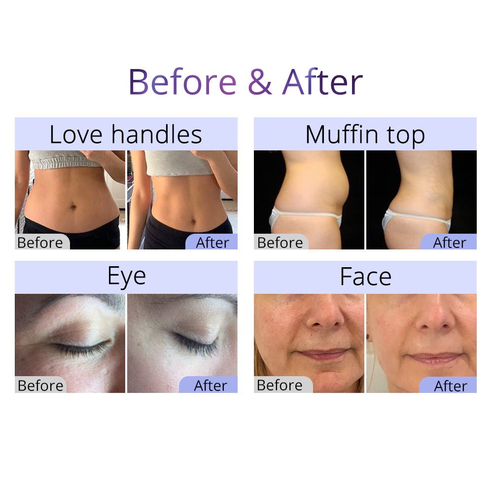 Shape Tactics 8-in-1 Cavitation RF Body Sculpting System
