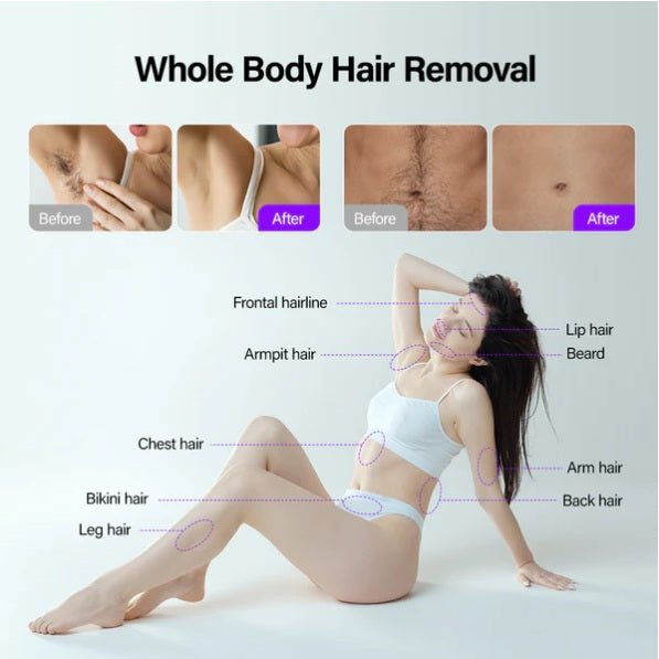 Shape Tactics Soprano Ice Pro 4-in-1 Laser Hair & Skin System